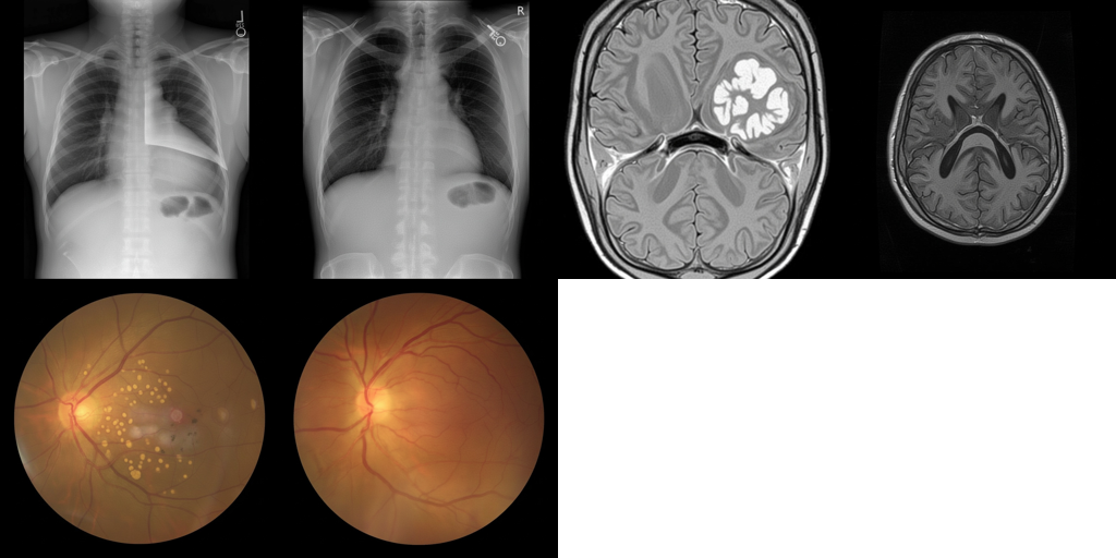 Med-Banana-50K: A Large-Scale Cross-Modality Dataset for Medical Image Editing